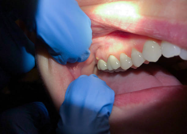 Best Emergency Dental Care for Broken or Chipped Teeth in , NE